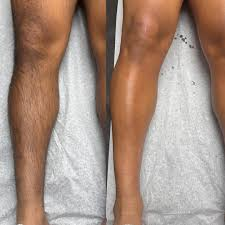 Full Legs Cerapil Premium Wax for men